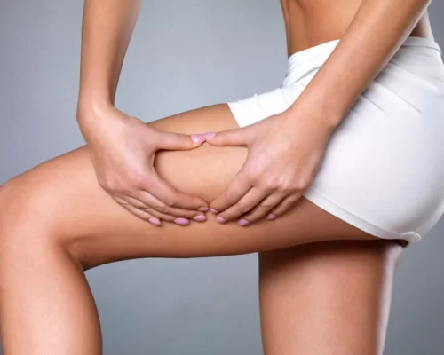 how-to-reduce-cellulite-in-just-30-days-1024x683.jpg