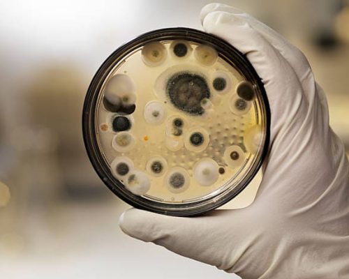 Image of mold in a petri dish