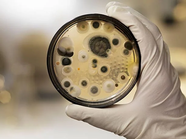 Image of mold in a petri dish